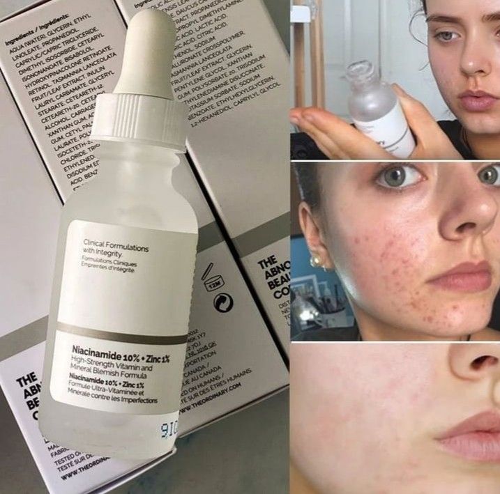 The Ordinary Niacinamide Serum